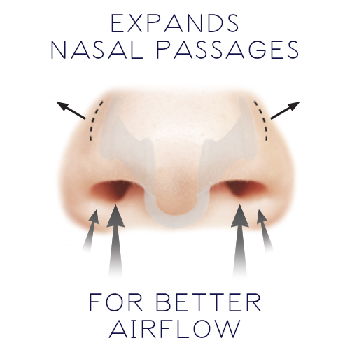 nasal-dilator-nose-clear dilator-arrows