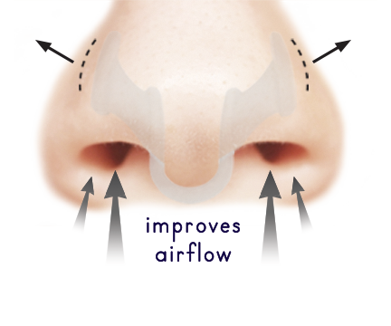 How To Use | AIRMAX Nasal Dilator